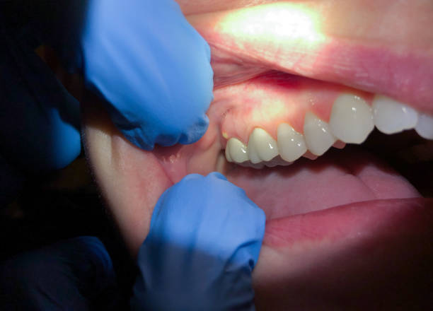 Best Dentist for Dental Trauma  in Brighton, AL