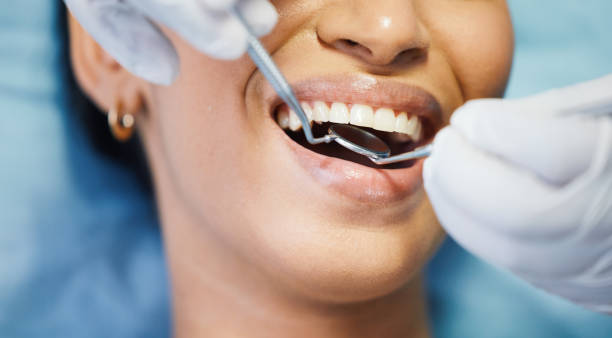 Best Knocked-Out Tooth Emergency  in Brighton, AL